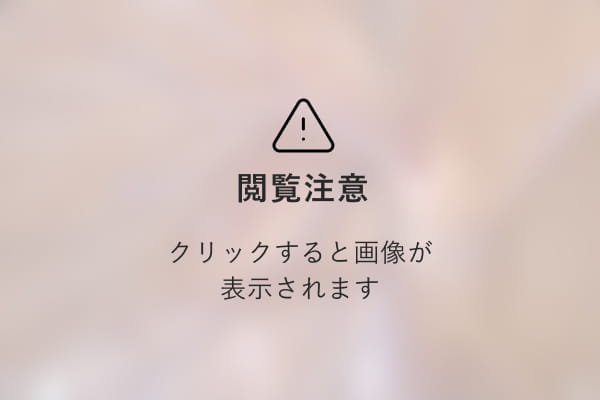 観覧注意